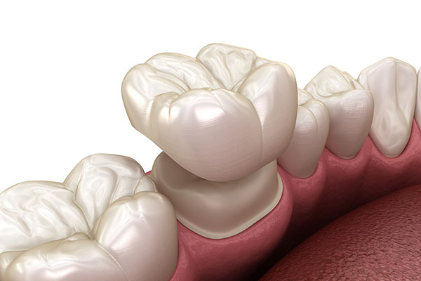 What Can Dental Crowns Do for Your Oral Health Issues? from Gentle Touch Dental Care in Forest Hills, NY