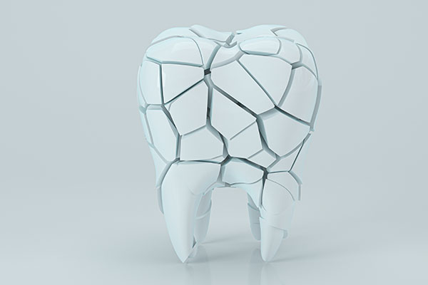 How Dental Bonding Can Repair Damaged Teeth