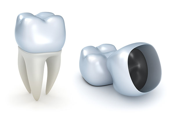 Tips To Help Dental Crowns Last Longer