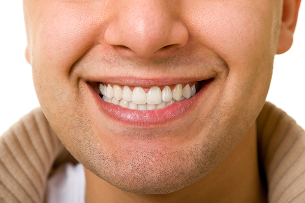 What Happens During A Dental Veneers Procedure