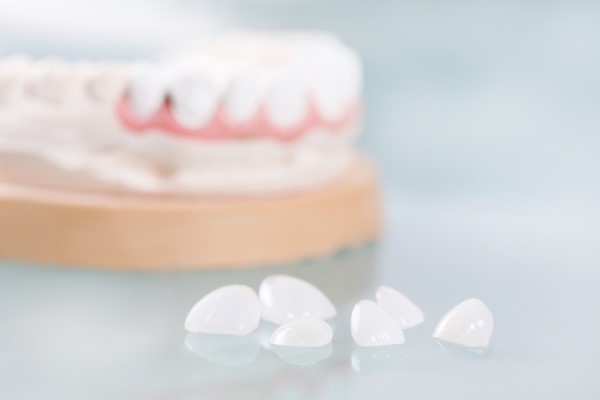 How Are Dental Veneers Made?