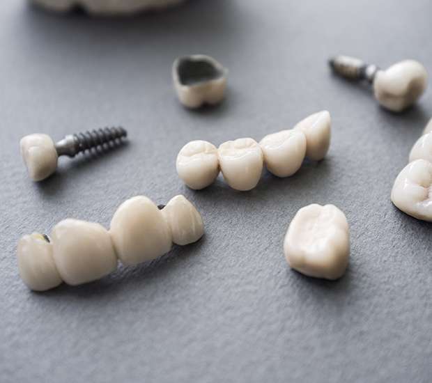 Forest Hills The Difference Between Dental Implants and Mini Dental Implants